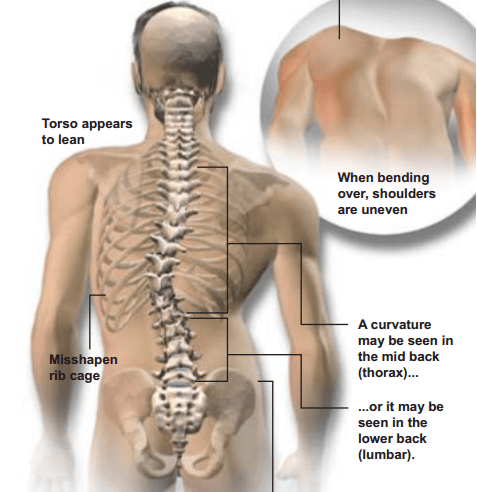 Woodstock chiropractic medical clinic automobile accident pain relief we work with your insurance and attorney
