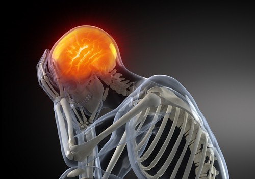 Migraine Headache Causes