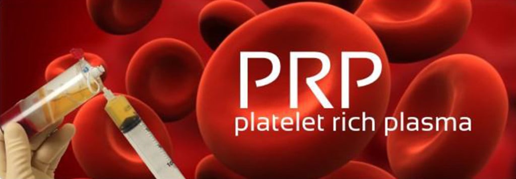 platelet-rich plasma