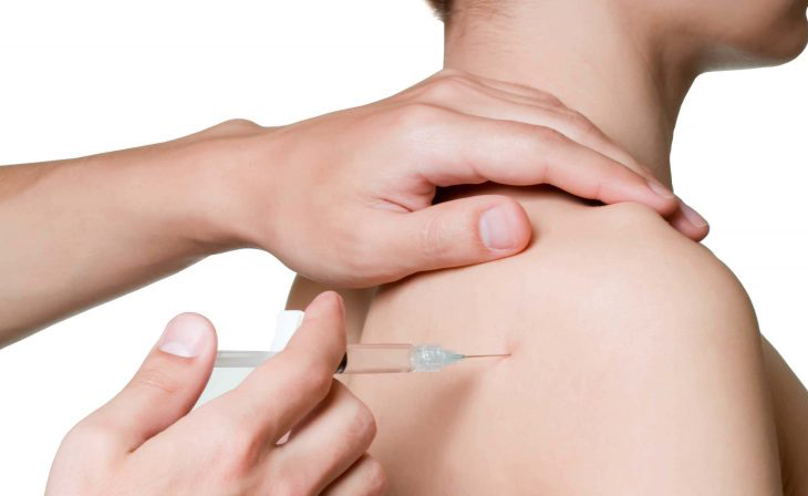 What Happens During a Trigger Point Injection