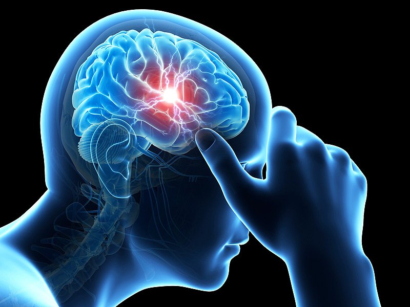 Signs of Concussion in A Loved One