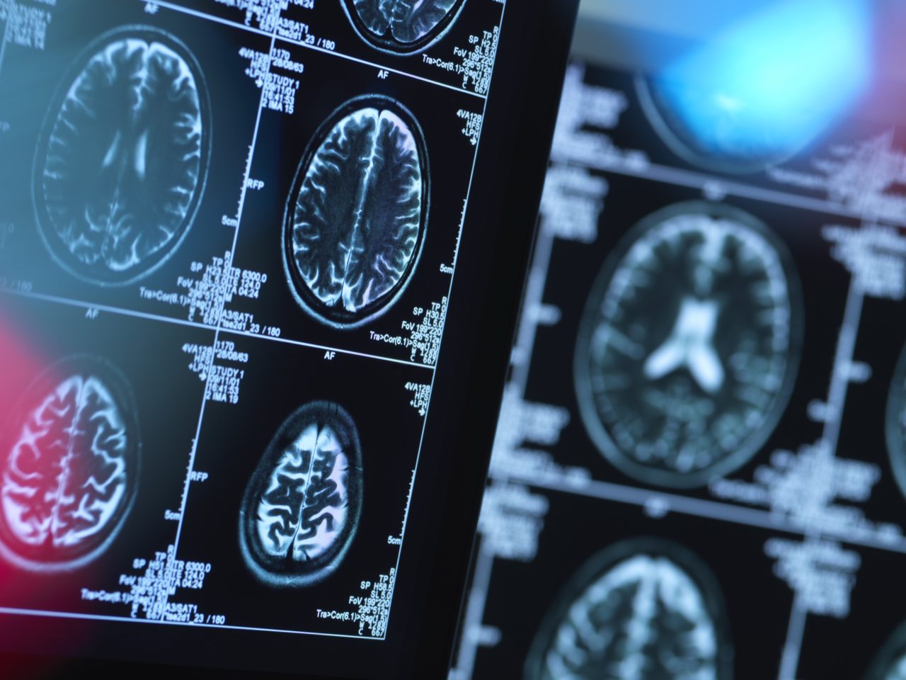Advanced Health Solutions: brain scans reviewed in a clinic