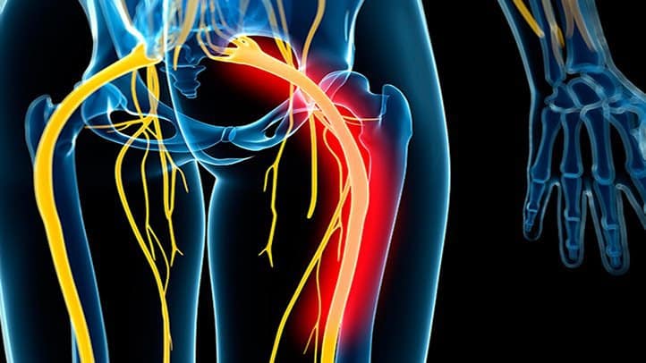 Advanced Health Solutions: genicular radiofrequency ablation for knee pain